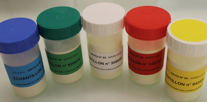 comparaison interlaboratoires